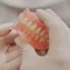 Dentures thumbnail