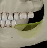 Dental model thumbnail
